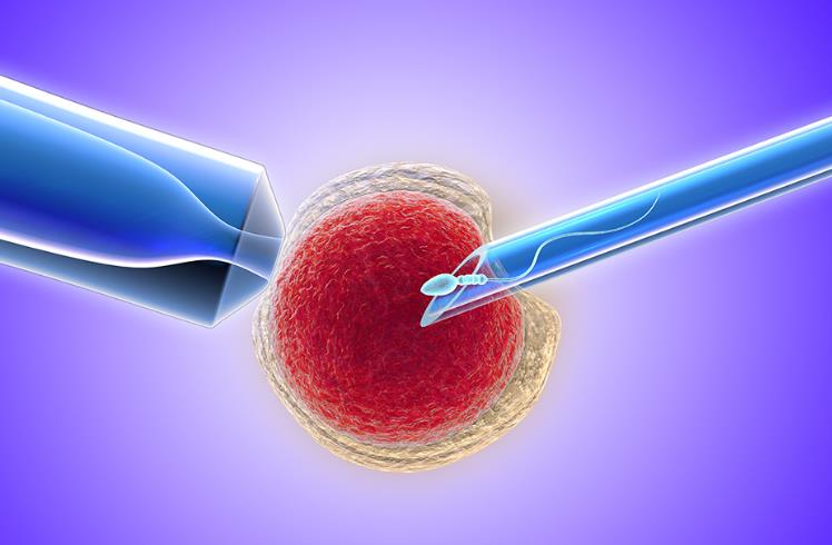 45岁做试管婴儿成功率